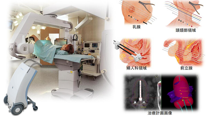放射線治療　BJR Supplement 25 放射線治療データ 1996 放射線治療計画ガイドライン 2012年版 | 日本放射線腫瘍学会 |本